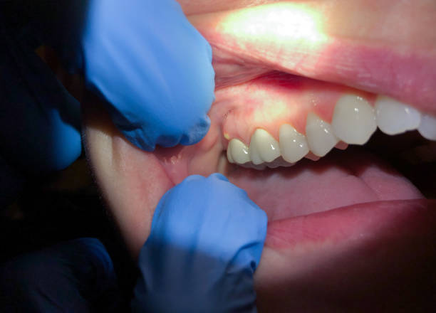 Best Emergency Treatment for Jaw Pain or Injury in Honokaa, HI