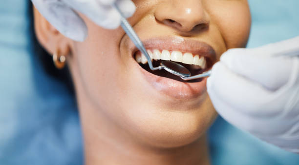 Best Emergency Wisdom Tooth Extraction in Honokaa, HI